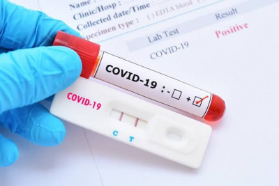 Kemenkes Tetapkan Tarif Pemeriksaan Rapid Test Antibodi
